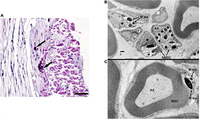 The Armadillo as a Model for Leprosy Nerve Function Impairment: Preventative and Therapeutic Interventions